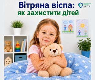 Вітряна віспа: як захистити дітей 